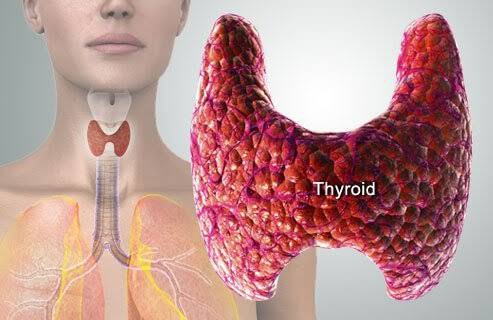 Thyroid