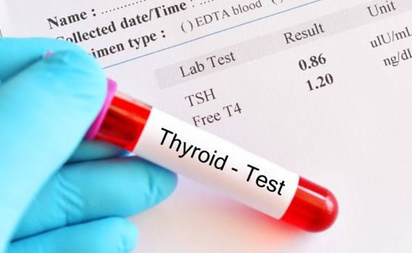 Thyroid Test