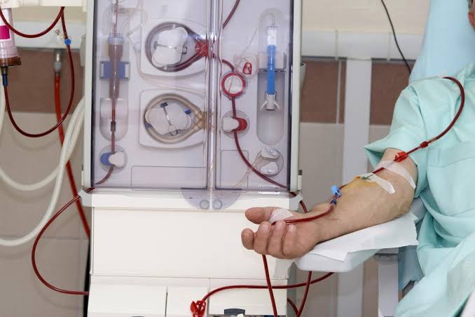 Kidney Dialysis