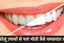 How Remove Strains From Teeth